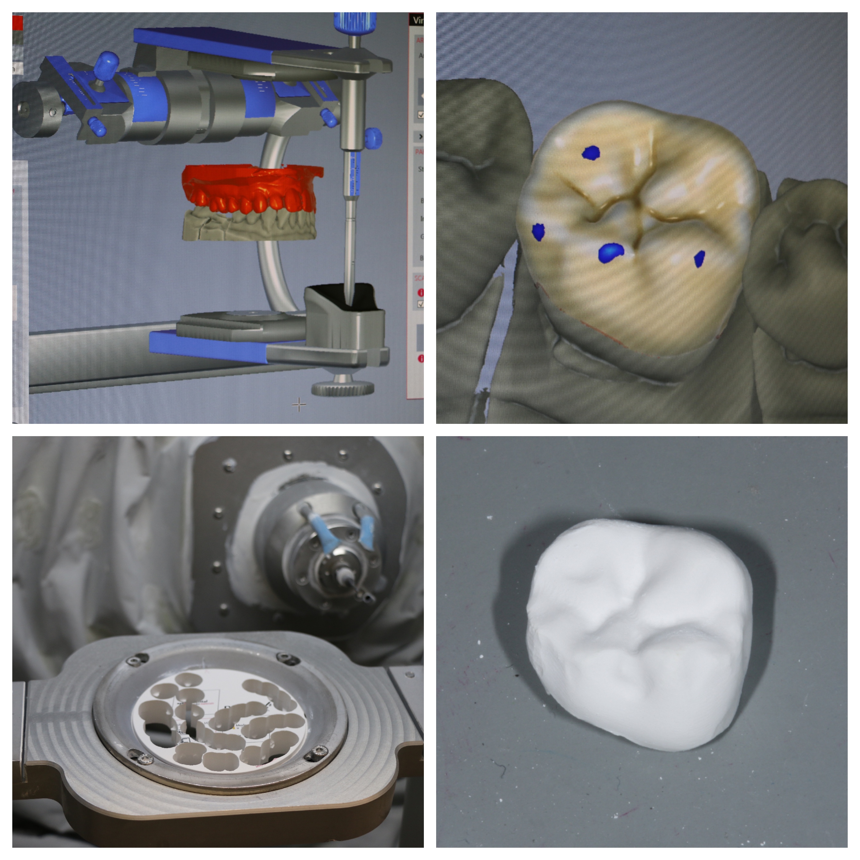 cad-cam-schlee-dental